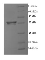 (Tris-Glycine gel) Discontinuous SDS-PAGE (reduced) with 5% enrichment gel and 15% separation gel. (Tris-Glycine gel) Discontinuous SDS-PAGE (reduced) with 5% enrichment gel and 15% separation gel.