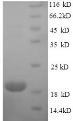 (Tris-Glycine gel) Discontinuous SDS-PAGE (reduced) with 5% enrichment gel and 15% separation gel. (Tris-Glycine gel) Discontinuous SDS-PAGE (reduced) with 5% enrichment gel and 15% separation gel.