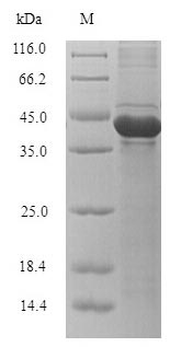 (Tris-Glycine gel) Discontinuous SDS-PAGE (reduced) with 5% enrichment gel and 15% separation gel.