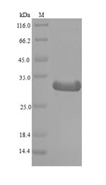 (Tris-Glycine gel) Discontinuous SDS-PAGE (reduced) with 5% enrichment gel and 15% separation gel. (Tris-Glycine gel) Discontinuous SDS-PAGE (reduced) with 5% enrichment gel and 15% separation gel.