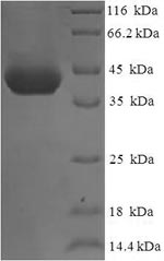 (Tris-Glycine gel) Discontinuous SDS-PAGE (reduced) with 5% enrichment gel and 15% separation gel.