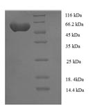 SDS-PAGE- Recombinant protein Human NIM1