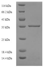 SDS-PAGE- Recombinant protein Human IL29