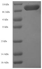 (Tris-Glycine gel) Discontinuous SDS-PAGE (reduced) with 5% enrichment gel and 15% separation gel. (Tris-Glycine gel) Discontinuous SDS-PAGE (reduced) with 5% enrichment gel and 15% separation gel.