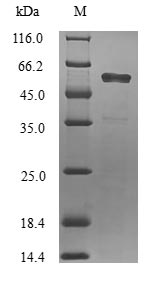 (Tris-Glycine gel) Discontinuous SDS-PAGE (reduced) with 5% enrichment gel and 15% separation gel. (Tris-Glycine gel) Discontinuous SDS-PAGE (reduced) with 5% enrichment gel and 15% separation gel.
