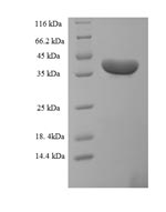 (Tris-Glycine gel) Discontinuous SDS-PAGE (reduced) with 5% enrichment gel and 15% separation gel. (Tris-Glycine gel) Discontinuous SDS-PAGE (reduced) with 5% enrichment gel and 15% separation gel.