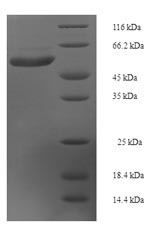 (Tris-Glycine gel) Discontinuous SDS-PAGE (reduced) with 5% enrichment gel and 15% separation gel. (Tris-Glycine gel) Discontinuous SDS-PAGE (reduced) with 5% enrichment gel and 15% separation gel.