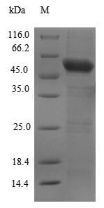 (Tris-Glycine gel) Discontinuous SDS-PAGE (reduced) with 5% enrichment gel and 15% separation gel. (Tris-Glycine gel) Discontinuous SDS-PAGE (reduced) with 5% enrichment gel and 15% separation gel.