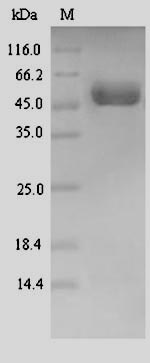(Tris-Glycine gel) Discontinuous SDS-PAGE (reduced) with 5% enrichment gel and 15% separation gel.