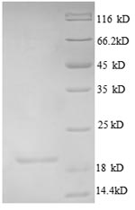 (Tris-Glycine gel) Discontinuous SDS-PAGE (reduced) with 5% enrichment gel and 15% separation gel. (Tris-Glycine gel) Discontinuous SDS-PAGE (reduced) with 5% enrichment gel and 15% separation gel.