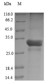 (Tris-Glycine gel) Discontinuous SDS-PAGE (reduced) with 5% enrichment gel and 15% separation gel.