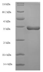 (Tris-Glycine gel) Discontinuous SDS-PAGE (reduced) with 5% enrichment gel and 15% separation gel.