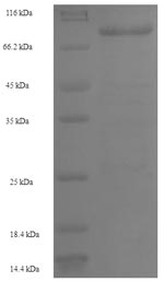 (Tris-Glycine gel) Discontinuous SDS-PAGE (reduced) with 5% enrichment gel and 15% separation gel. (Tris-Glycine gel) Discontinuous SDS-PAGE (reduced) with 5% enrichment gel and 15% separation gel.