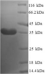(Tris-Glycine gel) Discontinuous SDS-PAGE (reduced) with 5% enrichment gel and 15% separation gel.