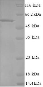 (Tris-Glycine gel) Discontinuous SDS-PAGE (reduced) with 5% enrichment gel and 15% separation gel. (Tris-Glycine gel) Discontinuous SDS-PAGE (reduced) with 5% enrichment gel and 15% separation gel.