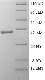 (Tris-Glycine gel) Discontinuous SDS-PAGE (reduced) with 5% enrichment gel and 15% separation gel.