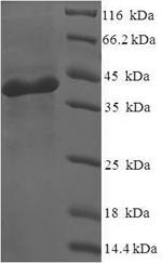 (Tris-Glycine gel) Discontinuous SDS-PAGE (reduced) with 5% enrichment gel and 15% separation gel.