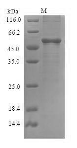 (Tris-Glycine gel) Discontinuous SDS-PAGE (reduced) with 5% enrichment gel and 15% separation gel.