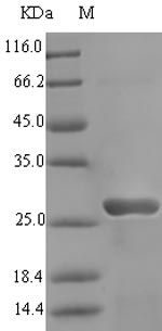 (Tris-Glycine gel) Discontinuous SDS-PAGE (reduced) with 5% enrichment gel and 15% separation gel. (Tris-Glycine gel) Discontinuous SDS-PAGE (reduced) with 5% enrichment gel and 15% separation gel.