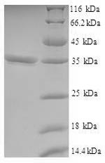 (Tris-Glycine gel) Discontinuous SDS-PAGE (reduced) with 5% enrichment gel and 15% separation gel. (Tris-Glycine gel) Discontinuous SDS-PAGE (reduced) with 5% enrichment gel and 15% separation gel.