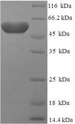 (Tris-Glycine gel) Discontinuous SDS-PAGE (reduced) with 5% enrichment gel and 15% separation gel. (Tris-Glycine gel) Discontinuous SDS-PAGE (reduced) with 5% enrichment gel and 15% separation gel.
