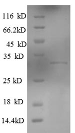 (Tris-Glycine gel) Discontinuous SDS-PAGE (reduced) with 5% enrichment gel and 15% separation gel. (Tris-Glycine gel) Discontinuous SDS-PAGE (reduced) with 5% enrichment gel and 15% separation gel.