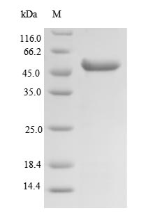 (Tris-Glycine gel) Discontinuous SDS-PAGE (reduced) with 5% enrichment gel and 15% separation gel. (Tris-Glycine gel) Discontinuous SDS-PAGE (reduced) with 5% enrichment gel and 15% separation gel.