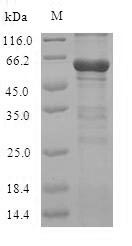 (Tris-Glycine gel) Discontinuous SDS-PAGE (reduced) with 5% enrichment gel and 15% separation gel. (Tris-Glycine gel) Discontinuous SDS-PAGE (reduced) with 5% enrichment gel and 15% separation gel.