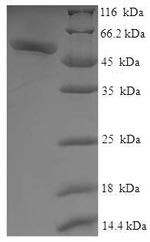 (Tris-Glycine gel) Discontinuous SDS-PAGE (reduced) with 5% enrichment gel and 15% separation gel. (Tris-Glycine gel) Discontinuous SDS-PAGE (reduced) with 5% enrichment gel and 15% separation gel.