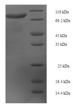 (Tris-Glycine gel) Discontinuous SDS-PAGE (reduced) with 5% enrichment gel and 15% separation gel. (Tris-Glycine gel) Discontinuous SDS-PAGE (reduced) with 5% enrichment gel and 15% separation gel.