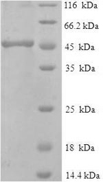 (Tris-Glycine gel) Discontinuous SDS-PAGE (reduced) with 5% enrichment gel and 15% separation gel. (Tris-Glycine gel) Discontinuous SDS-PAGE (reduced) with 5% enrichment gel and 15% separation gel.