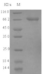 (Tris-Glycine gel) Discontinuous SDS-PAGE (reduced) with 5% enrichment gel and 15% separation gel. (Tris-Glycine gel) Discontinuous SDS-PAGE (reduced) with 5% enrichment gel and 15% separation gel.