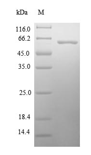 (Tris-Glycine gel) Discontinuous SDS-PAGE (reduced) with 5% enrichment gel and 15% separation gel. (Tris-Glycine gel) Discontinuous SDS-PAGE (reduced) with 5% enrichment gel and 15% separation gel.
