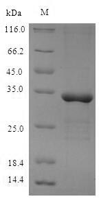 (Tris-Glycine gel) Discontinuous SDS-PAGE (reduced) with 5% enrichment gel and 15% separation gel. (Tris-Glycine gel) Discontinuous SDS-PAGE (reduced) with 5% enrichment gel and 15% separation gel.