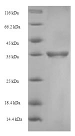 CSB-EP855470HU SDS-PAGE