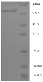 (Tris-Glycine gel) Discontinuous SDS-PAGE (reduced) with 5% enrichment gel and 15% separation gel. (Tris-Glycine gel) Discontinuous SDS-PAGE (reduced) with 5% enrichment gel and 15% separation gel.