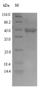 (Tris-Glycine gel) Discontinuous SDS-PAGE (reduced) with 5% enrichment gel and 15% separation gel.