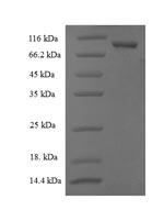 (Tris-Glycine gel) Discontinuous SDS-PAGE (reduced) with 5% enrichment gel and 15% separation gel. (Tris-Glycine gel) Discontinuous SDS-PAGE (reduced) with 5% enrichment gel and 15% separation gel.