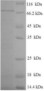 (Tris-Glycine gel) Discontinuous SDS-PAGE (reduced) with 5% enrichment gel and 15% separation gel. (Tris-Glycine gel) Discontinuous SDS-PAGE (reduced) with 5% enrichment gel and 15% separation gel.