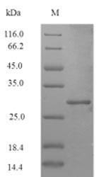 (Tris-Glycine gel) Discontinuous SDS-PAGE (reduced) with 5% enrichment gel and 15% separation gel. (Tris-Glycine gel) Discontinuous SDS-PAGE (reduced) with 5% enrichment gel and 15% separation gel.