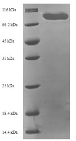 (Tris-Glycine gel) Discontinuous SDS-PAGE (reduced) with 5% enrichment gel and 15% separation gel. (Tris-Glycine gel) Discontinuous SDS-PAGE (reduced) with 5% enrichment gel and 15% separation gel.