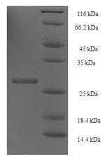 (Tris-Glycine gel) Discontinuous SDS-PAGE (reduced) with 5% enrichment gel and 15% separation gel. (Tris-Glycine gel) Discontinuous SDS-PAGE (reduced) with 5% enrichment gel and 15% separation gel.