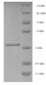 (Tris-Glycine gel) Discontinuous SDS-PAGE (reduced) with 5% enrichment gel and 15% separation gel. (Tris-Glycine gel) Discontinuous SDS-PAGE (reduced) with 5% enrichment gel and 15% separation gel.