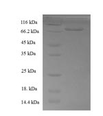 (Tris-Glycine gel) Discontinuous SDS-PAGE (reduced) with 5% enrichment gel and 15% separation gel. (Tris-Glycine gel) Discontinuous SDS-PAGE (reduced) with 5% enrichment gel and 15% separation gel.
