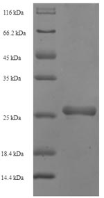 (Tris-Glycine gel) Discontinuous SDS-PAGE (reduced) with 5% enrichment gel and 15% separation gel.