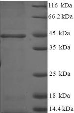 (Tris-Glycine gel) Discontinuous SDS-PAGE (reduced) with 5% enrichment gel and 15% separation gel. (Tris-Glycine gel) Discontinuous SDS-PAGE (reduced) with 5% enrichment gel and 15% separation gel.