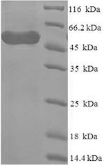 SDS-PAGE- Recombinant protein Human WDR77