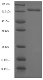 (Tris-Glycine gel) Discontinuous SDS-PAGE (reduced) with 5% enrichment gel and 15% separation gel. (Tris-Glycine gel) Discontinuous SDS-PAGE (reduced) with 5% enrichment gel and 15% separation gel.
