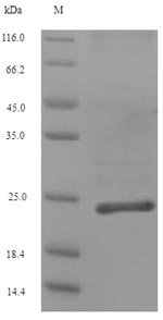 (Tris-Glycine gel) Discontinuous SDS-PAGE (reduced) with 5% enrichment gel and 15% separation gel. (Tris-Glycine gel) Discontinuous SDS-PAGE (reduced) with 5% enrichment gel and 15% separation gel.