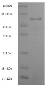(Tris-Glycine gel) Discontinuous SDS-PAGE (reduced) with 5% enrichment gel and 15% separation gel. (Tris-Glycine gel) Discontinuous SDS-PAGE (reduced) with 5% enrichment gel and 15% separation gel.